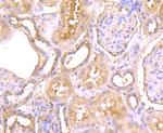 CTHRC1 Antibody in Immunohistochemistry (Paraffin) (IHC (P))