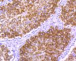 YBX2 Antibody in Immunohistochemistry (Paraffin) (IHC (P))