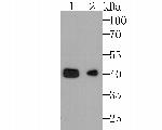 YBX2 Antibody in Western Blot (WB)