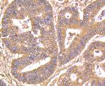 GRB2 Antibody in Immunohistochemistry (Paraffin) (IHC (P))