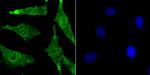 BMI-1 Antibody in Immunocytochemistry (ICC/IF)