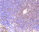 BMI-1 Antibody in Immunohistochemistry (Paraffin) (IHC (P))