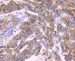 BMI-1 Antibody in Immunohistochemistry (Paraffin) (IHC (P))