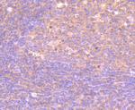 PI3K p85 alpha Antibody in Immunohistochemistry (Paraffin) (IHC (P))