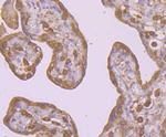 PI3K p85 alpha Antibody in Immunohistochemistry (Paraffin) (IHC (P))