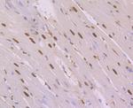 NFIB Antibody in Immunohistochemistry (Paraffin) (IHC (P))