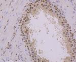 NFIB Antibody in Immunohistochemistry (Paraffin) (IHC (P))