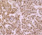 NFIB Antibody in Immunohistochemistry (Paraffin) (IHC (P))