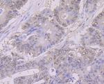 NFIB Antibody in Immunohistochemistry (Paraffin) (IHC (P))