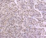 NFIB Antibody in Immunohistochemistry (Paraffin) (IHC (P))