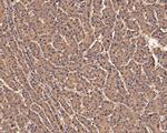 PRDX2 Antibody in Immunohistochemistry (Paraffin) (IHC (P))