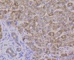 ALDH4A1 Antibody in Immunohistochemistry (Paraffin) (IHC (P))