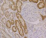 ALDH4A1 Antibody in Immunohistochemistry (Paraffin) (IHC (P))