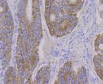 ALDH4A1 Antibody in Immunohistochemistry (Paraffin) (IHC (P))