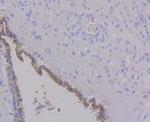 ALDH4A1 Antibody in Immunohistochemistry (Paraffin) (IHC (P))