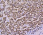 ALDH4A1 Antibody in Immunohistochemistry (Paraffin) (IHC (P))