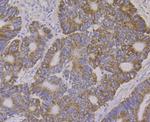 ALDH4A1 Antibody in Immunohistochemistry (Paraffin) (IHC (P))