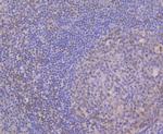 CUGBP1 Antibody in Immunohistochemistry (Paraffin) (IHC (P))