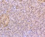 CUGBP1 Antibody in Immunohistochemistry (Paraffin) (IHC (P))