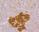 PGP9.5 Antibody in Immunohistochemistry (Paraffin) (IHC (P))