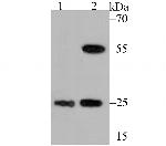 PGP9.5 Antibody in Western Blot (WB)