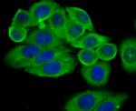 ASS1 Antibody in Immunocytochemistry (ICC/IF)