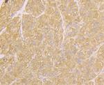 TNFRSF11B Antibody in Immunohistochemistry (Paraffin) (IHC (P))