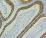 ALDH1A1 Antibody in Immunohistochemistry (Paraffin) (IHC (P))