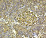 ALDH1A1 Antibody in Immunohistochemistry (Paraffin) (IHC (P))