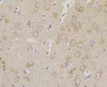 Carbonic Anhydrase II Antibody in Immunohistochemistry (Paraffin) (IHC (P))