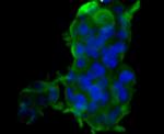 Carbonic Anhydrase II Antibody in Immunocytochemistry (ICC/IF)