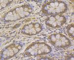 Carbonic Anhydrase II Antibody in Immunohistochemistry (Paraffin) (IHC (P))