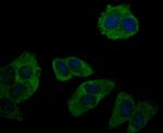 RNASE3 Antibody in Immunocytochemistry (ICC/IF)