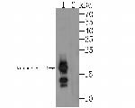 RNASE3 Antibody in Western Blot (WB)