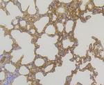 GSTP1 Antibody in Immunohistochemistry (Paraffin) (IHC (P))