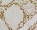 GSTP1 Antibody in Immunohistochemistry (Paraffin) (IHC (P))