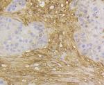 GSTP1 Antibody in Immunohistochemistry (Paraffin) (IHC (P))