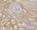 GSTP1 Antibody in Immunohistochemistry (Paraffin) (IHC (P))