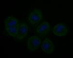 Stathmin 1 Antibody in Immunocytochemistry (ICC/IF)