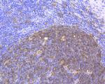 Stathmin 1 Antibody in Immunohistochemistry (Paraffin) (IHC (P))