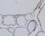 NME1 Antibody in Immunohistochemistry (Paraffin) (IHC (P))