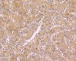 NME1 Antibody in Immunohistochemistry (Paraffin) (IHC (P))