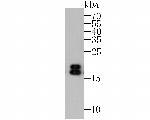 NME1 Antibody in Western Blot (WB)