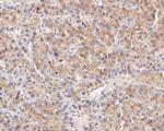 NME1 Antibody in Immunohistochemistry (Paraffin) (IHC (P))