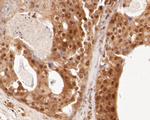 NME1 Antibody in Immunohistochemistry (Paraffin) (IHC (P))