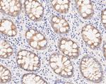 MGST1 Antibody in Immunohistochemistry (Paraffin) (IHC (P))