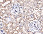 MGST1 Antibody in Immunohistochemistry (Paraffin) (IHC (P))