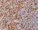 Thymidine Phosphorylase Antibody in Immunohistochemistry (Paraffin) (IHC (P))