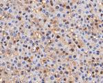 Thymidine Phosphorylase Antibody in Immunohistochemistry (Paraffin) (IHC (P))