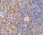 Thymidine Phosphorylase Antibody in Immunohistochemistry (Paraffin) (IHC (P))